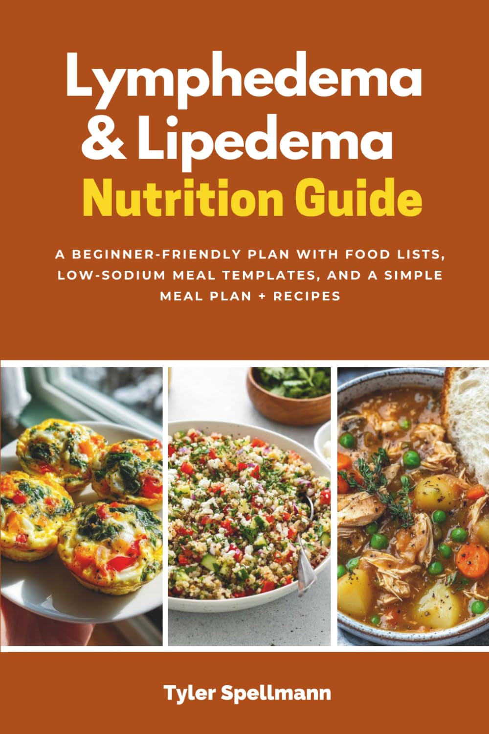 Lymphedema & Lipedema Nutrition Guide: A Beginner-Friendly Plan with Food Lists, Low-Sodium Meal Templates, and a Simple Meal Plan + Recipes