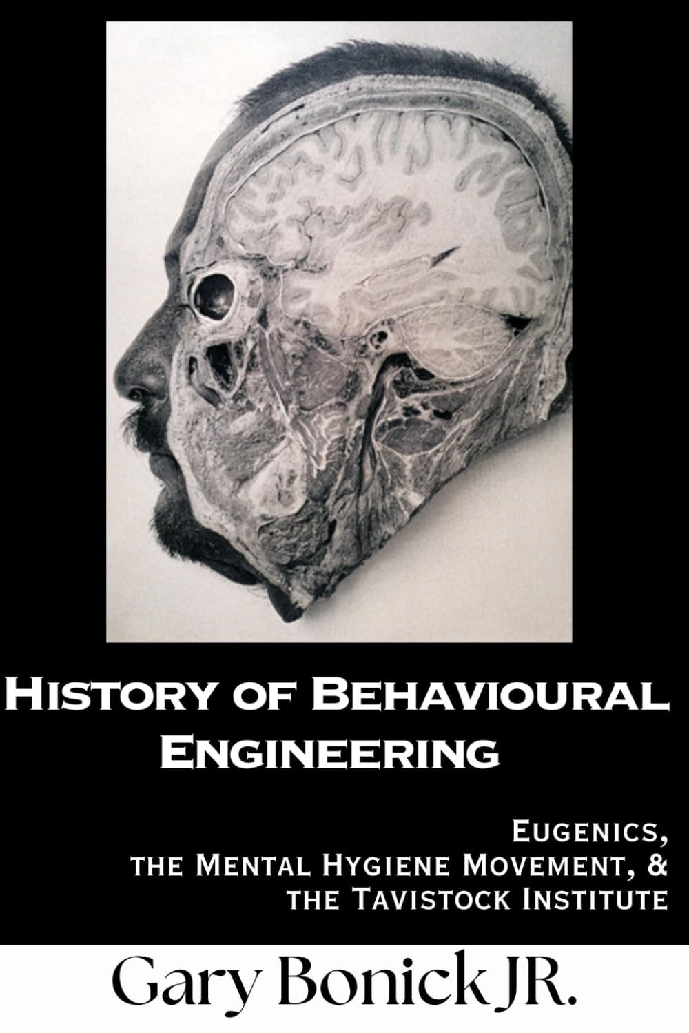 History of Behavioural Engineering: Eugenics, The Mental Hygiene Movement & the Tavistock Institute