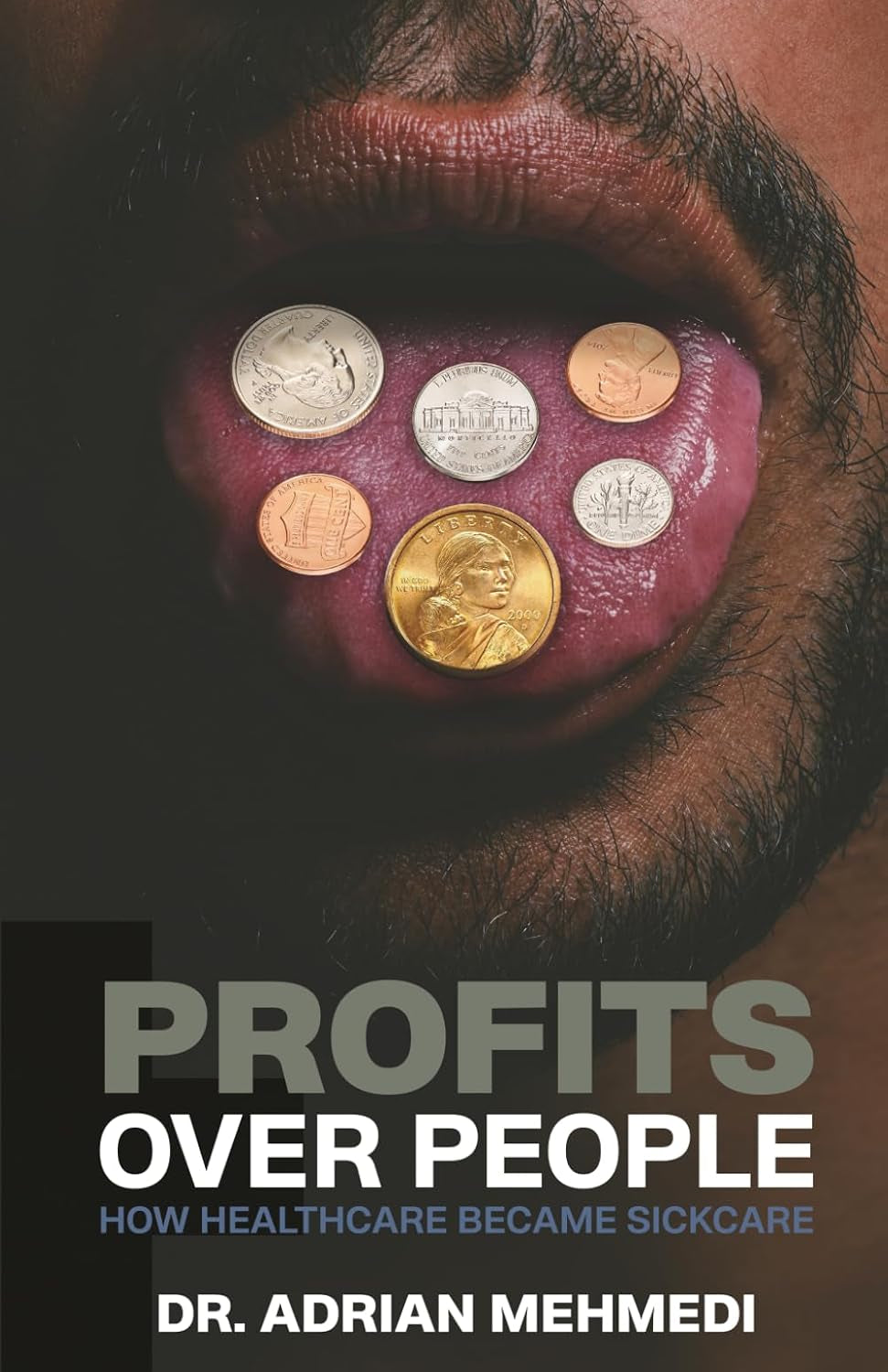 Profits Over People: How Healthcare Became Sickcare