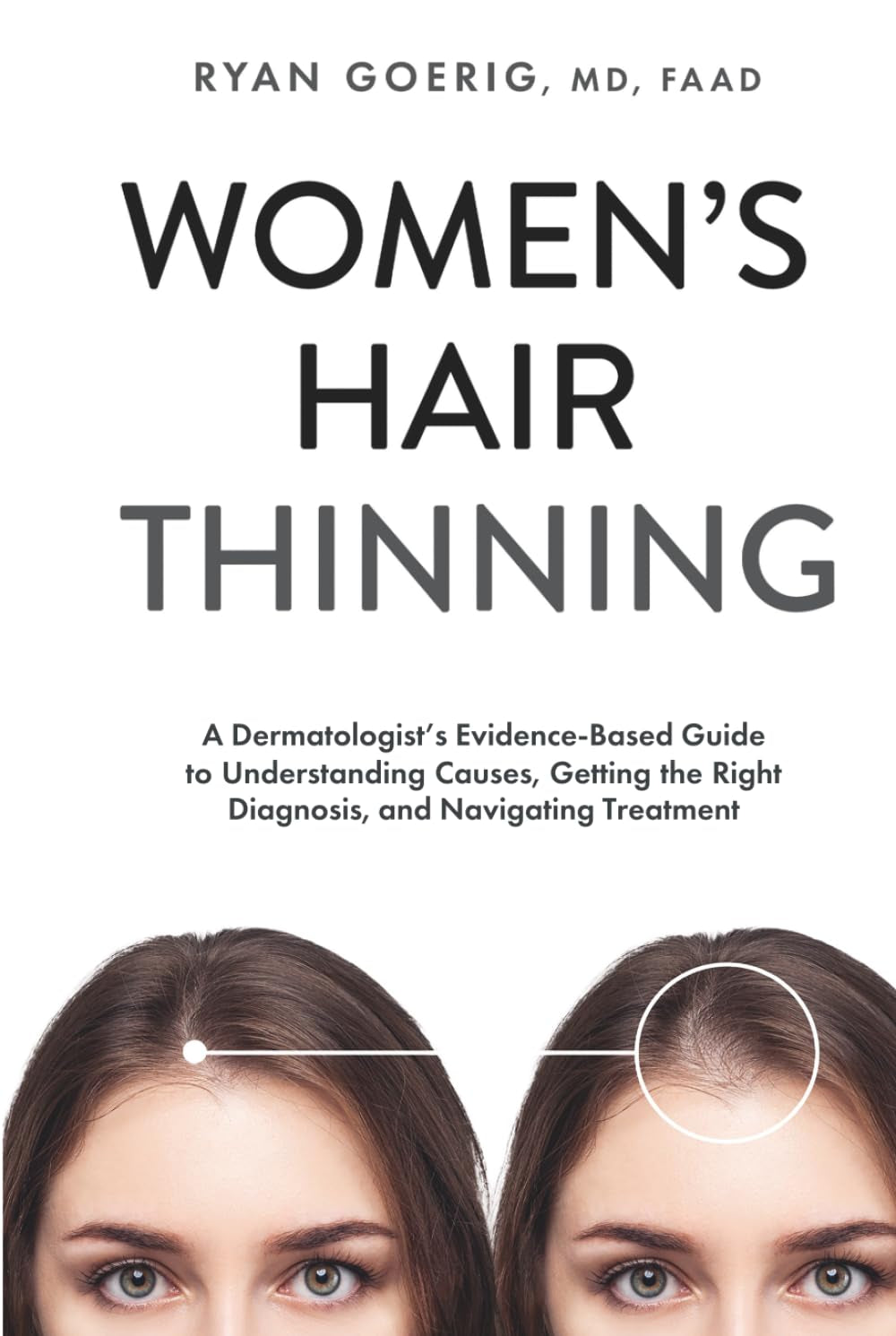 Women's Hair Thinning: A Dermatologist's Evidence-Based Guide to Understanding Causes, Getting the Right Diagnosis, and Navigating Treatment